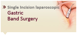 Gastric Band Surgery